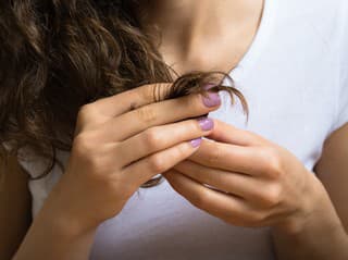 Keď VLASY kričia SOS: