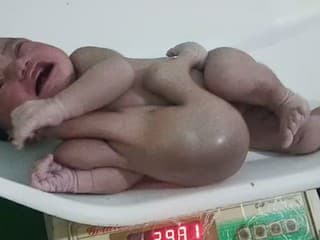 Žena porodila dievčatko so