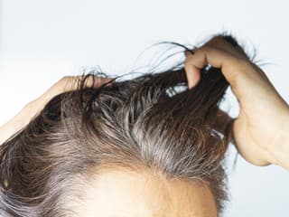 DEMENCIA sa môže ukázať