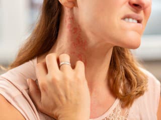 Farba kože môže odhaliť