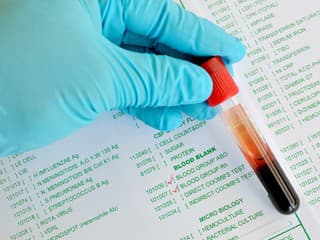 Máte túto krvnú SKUPINU?