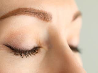 LIFTING očných VIEČOK bez