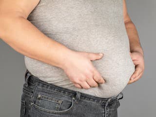 FOTO Extrémna PREMENA, ktorá