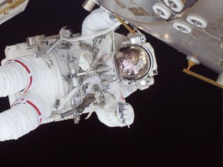 Môže pobyt vo vesmíre