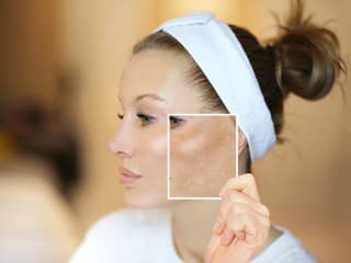 Ako ZOSVETLIŤ pokožku bez