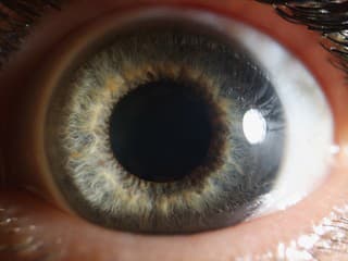 RIZIKO srdcového ochorenia možno