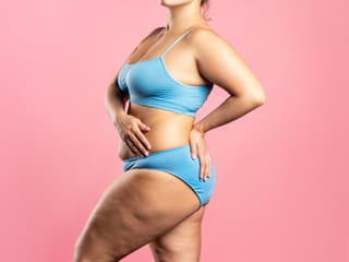 Výhoda s názvom CELULITÍDA: