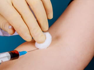 ALZHEIMEROVA choroba môže DRIEMAŤ