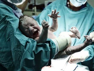 Unikátna FOTO z pôrodu
