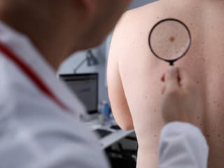 DOPLNOK výživy ako ochranný