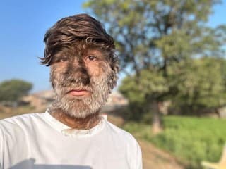 Vieš, čo sa skrýva