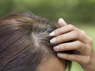 VIAC než len starnutie: