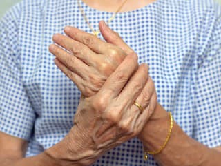 Pociťujete v končatinách tŕpnutie,