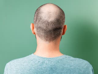 ZNAK, ktorý prezradí riziko