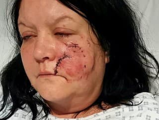 Ženu (43) napadol kamarátkin
