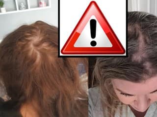 Desiatky žien žalujú TÚTO