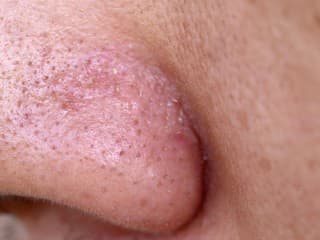 NAJLEPŠÍ bojovníci, ktorí odstránia