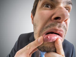 Čo ZABERÁ na biele