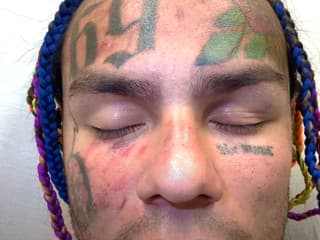 Dobitý 6ix9ine rozdáva peniaze