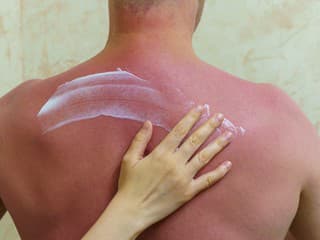 DERMATOLÓGOVIA varujú na ČASTO