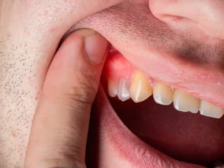 MENEJ známe dôvody, prečo