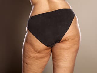 Tri druhy OVOCIA, ktoré