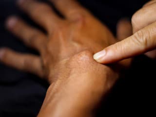 Máte na ruke zvláštny