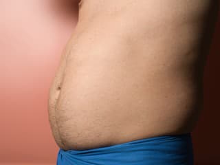 TUK alebo nafúknuté brucho?