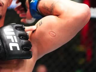 VIDEO: Zbláznil sa?! Brazílsky