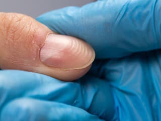 Polmesiačiky na nechtoch odhalia,