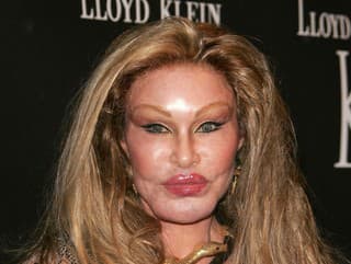 Jocelyn Wildenstein.