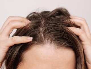 KONIEC krehkým lámavým vlasom