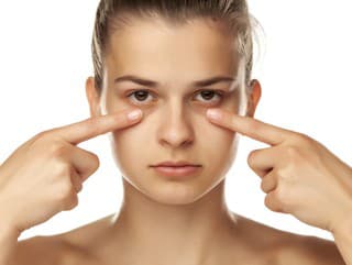 Vačkov pod očami sa