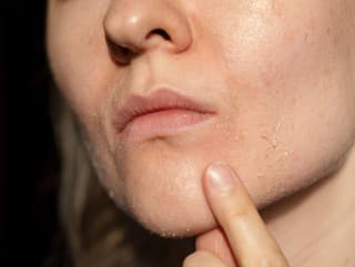 Pupienky vždy na tom