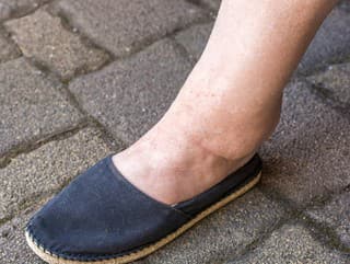 Zadrživanej vody sa zbavíte