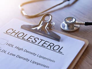 Nie všetko, čo ste