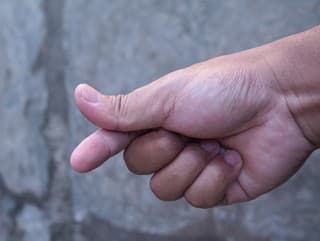 Palec ako z gumy?