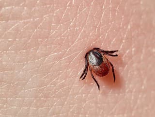 Kliešť: TIETO chyby pri