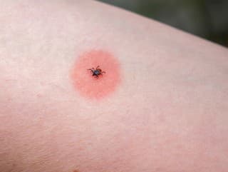 Leto, príroda a... borelióza?