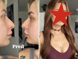 Známa kráska 2 týždne