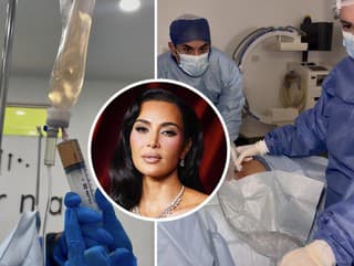 Bolestivé ZRANENIE Kim Kardashian: