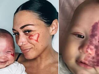 Austrálčanka Brooke Atkinsová čelila