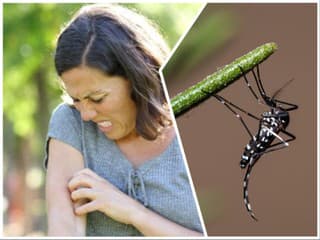 Experti radia: Neuveríte, čo