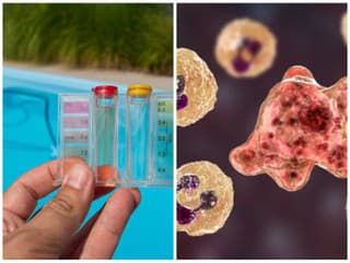 Ďalší smrteľný prípad mozgožravej