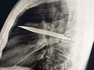 Lekári v Tanzánii neverili