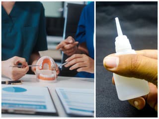 Zubárka prekročila všetky hranice