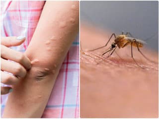 Vedci odhalili prekvapivú súvislosť: