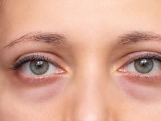 Tieto ČUDNÉ PRÍZNAKY OČÍ