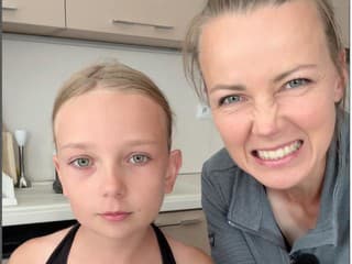 Viete, ako ukážkovo ošúpať