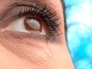 Ako zastaviť slzenie očí: